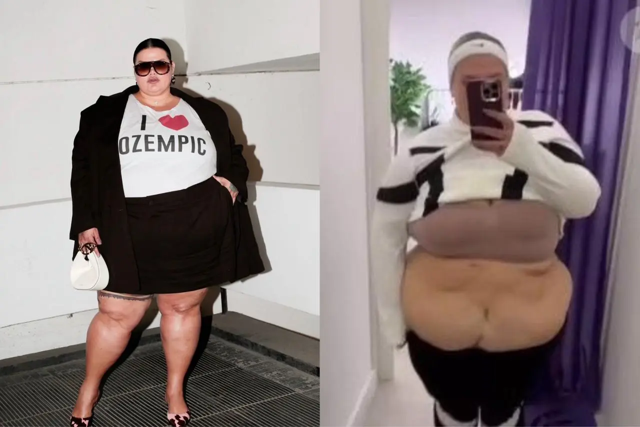 Thaís Carla perde 50 kg em menos de um ano e médica fala sobre pele flácida após emagrecimento
